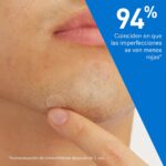 Cerave Parches Control Imperfecciones - Imagen 3