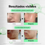 VT Cosmetics Reedle Shot 50 CICA - Imagen 4