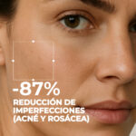Segle Neceser Acné AHA BHA + Clear Azelaic 30 ml - Imagen 3